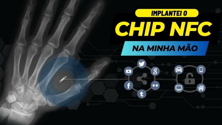 A verdade chocante sobre o implante do chip NFC na minha mão